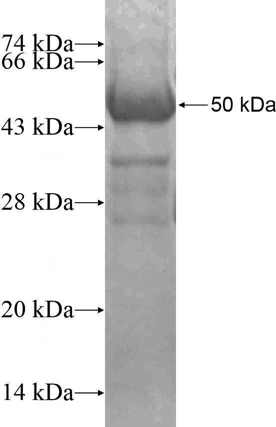 Recombinant Human KIAA0406 SDS-PAGE