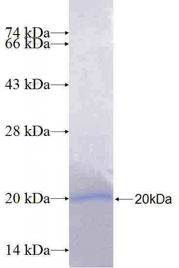 Recombinant Human PRKCQ SDS-PAGE