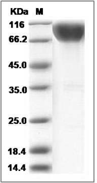 Rat IL17RA / IL17R Protein (Fc Tag) SDS-PAGE
