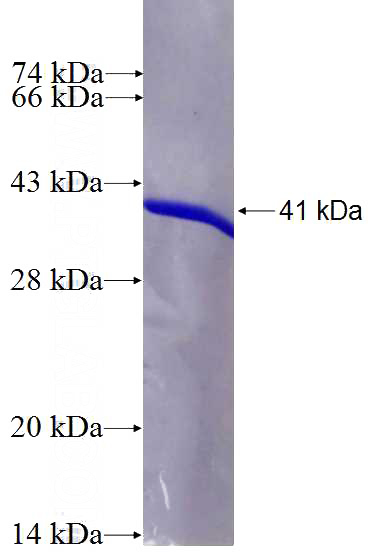 Recombinant Human CALM3 SDS-PAGE