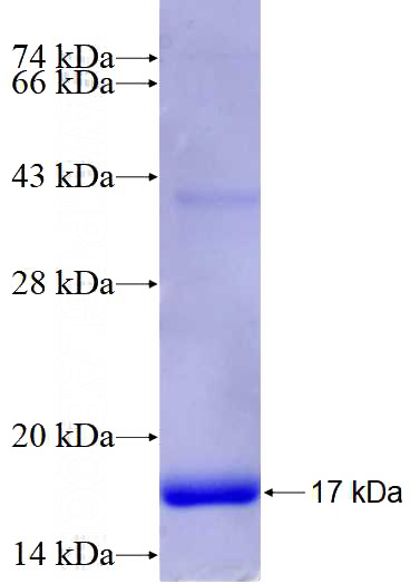 Recombinant Human ITGAV SDS-PAGE