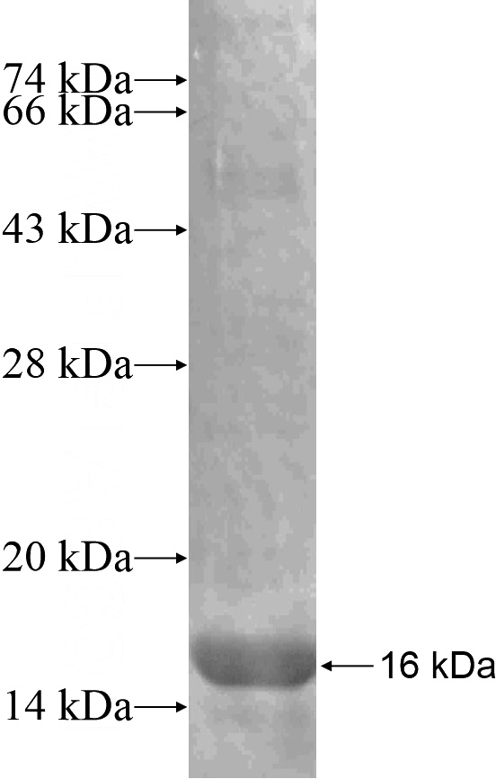 Recombinant Human KRT7 SDS-PAGE