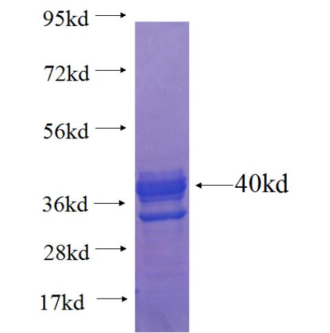 Recombinant human CCNO SDS-PAGE