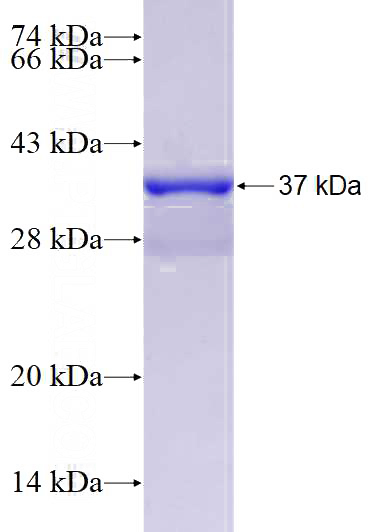Recombinant Human P16-INK4A SDS-PAGE