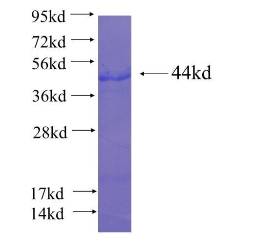Recombinant human KIAA1429 SDS-PAGE