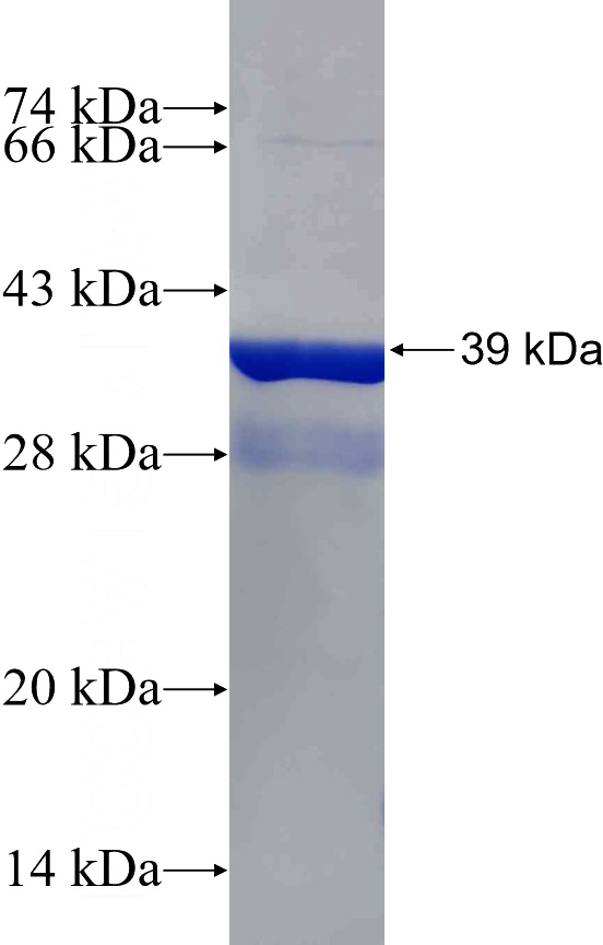 Recombinant Human LRIG2 SDS-PAGE