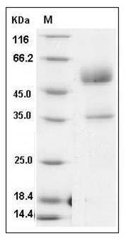 Mouse PIGF / PLGF Protein (Fc Tag) SDS-PAGE