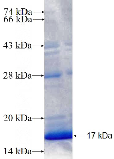 Recombinant Human TBK1 SDS-PAGE