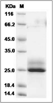 Human FKBP14 Protein (His Tag) SDS-PAGE