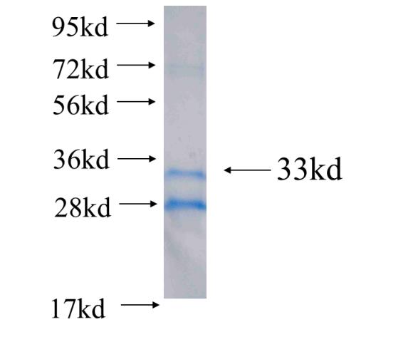 Recombinant human SLC2A2 SDS-PAGE