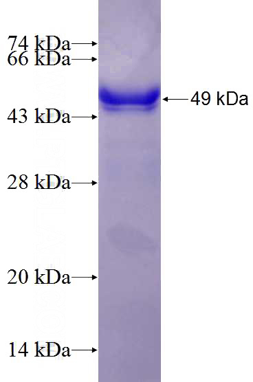 Recombinant Human SNAP23 SDS-PAGE