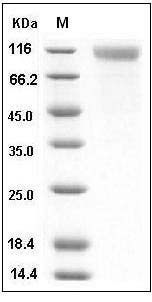 Human SCARB1 / CD36L1 / CLA-1 Protein (His & Fc Tag) SDS-PAGE