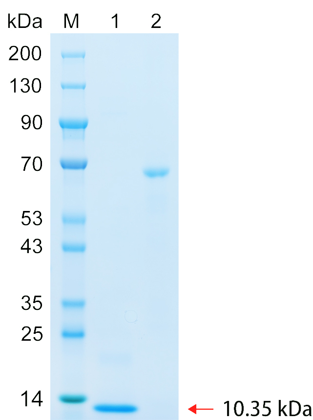 Recombinant TM204 protein (His tag) SDS-PAGE
