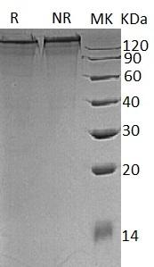 Mouse Col3a1 (His tag) recombinant protein