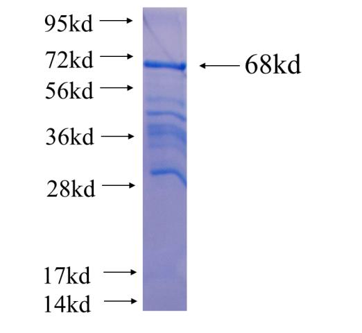 Recombinant human HRD1 SDS-PAGE