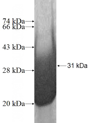 Recombinant Human EXOSC5 SDS-PAGE