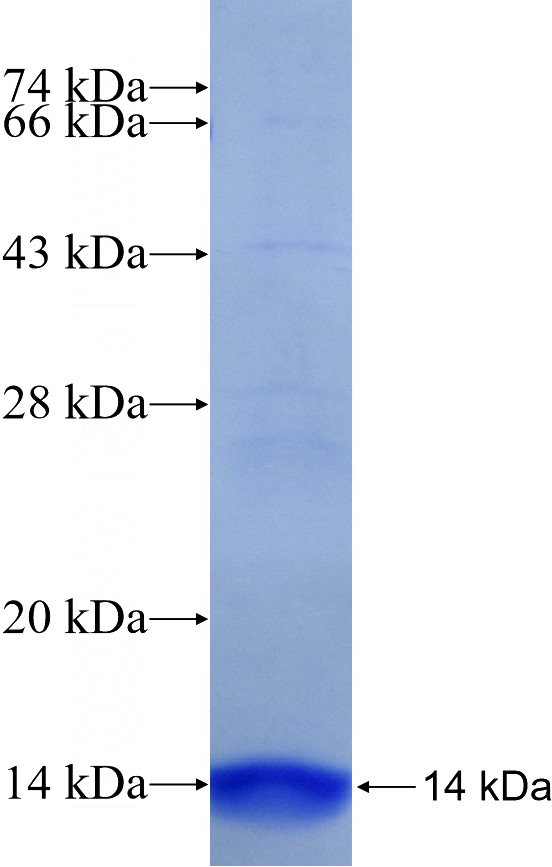 Recombinant Human CYP21A2 SDS-PAGE