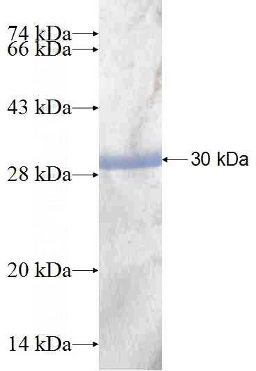 Recombinant Human PSMA7 SDS-PAGE
