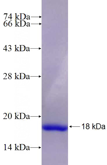 Recombinant Human PNPLA3 SDS-PAGE