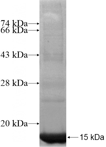 Recombinant Human LYRM1 SDS-PAGE