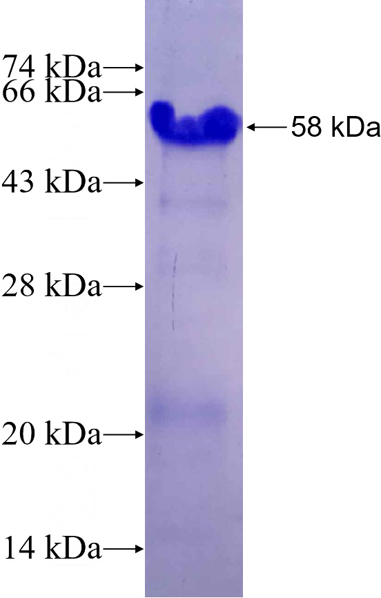 Recombinant Human RIC3 SDS-PAGE