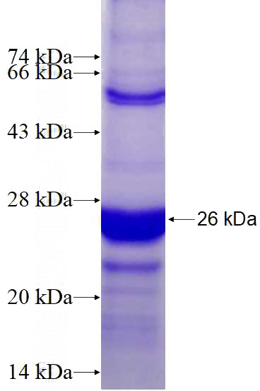 Recombinant Human ANKRD7 SDS-PAGE