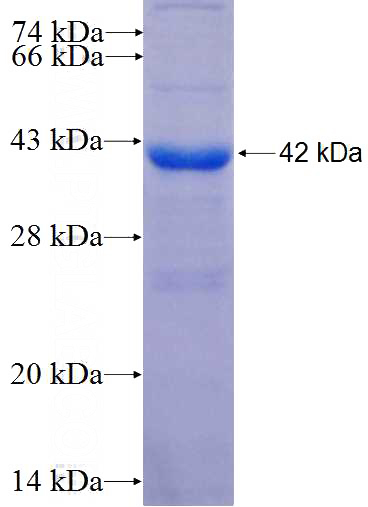 Recombinant Human CHRD SDS-PAGE