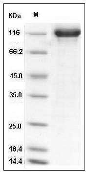 Rat Tie2 / TEK Protein (Fc Tag) SDS-PAGE