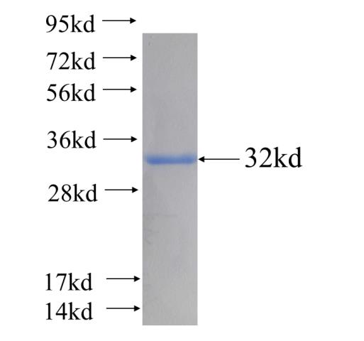 Recombinant human FAM176A SDS-PAGE