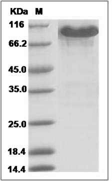 Mouse EphA3 Protein (Fc Tag) SDS-PAGE