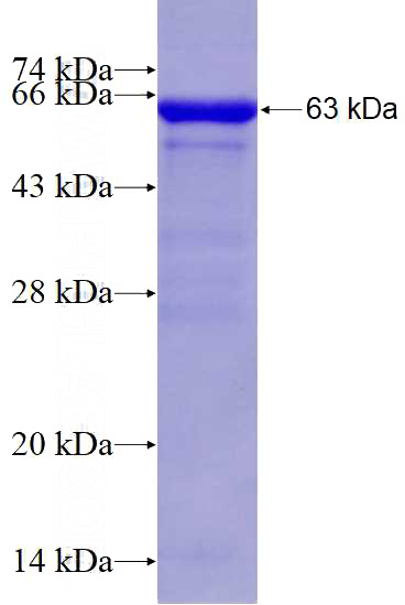 Recombinant Human NEDD4 SDS-PAGE