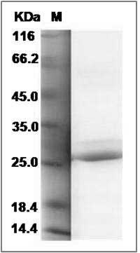 Human Cytoglobin / CYGB Protein (His Tag) SDS-PAGE