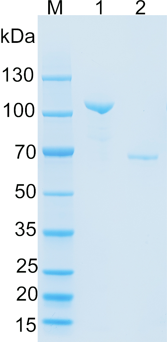 Human AARS1 Recombinant protein (His tag)