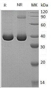 Human SERPINB9/PI9 (His tag) recombinant protein
