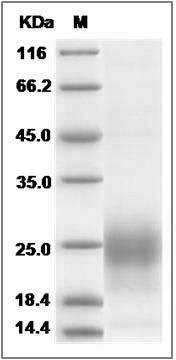 Human TETHERIN / BST2 / CD317 Protein (His Tag) SDS-PAGE