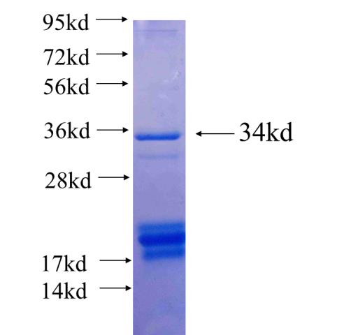 Recombinant human PNO1(Full length) SDS-PAGE