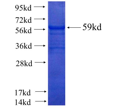 Recombinant human SNX17 SDS-PAGE
