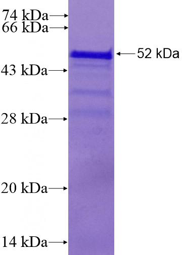 Recombinant Human CHCHD6 SDS-PAGE