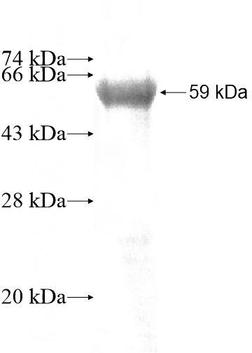 Recombinant Human DOHH SDS-PAGE