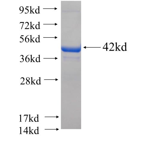 Recombinant human HDDC3 SDS-PAGE