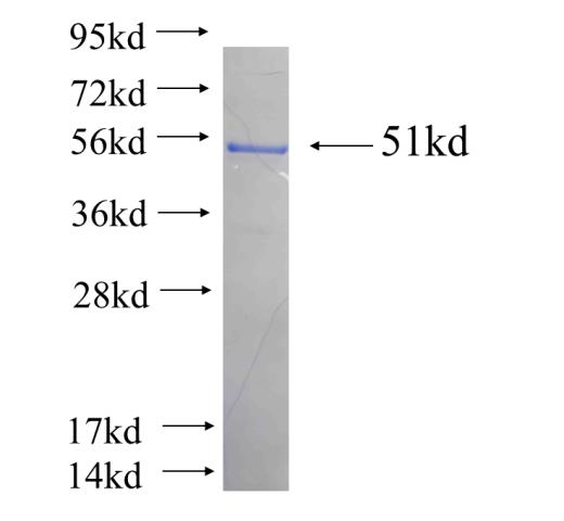 Recombinant human RAB3B SDS-PAGE
