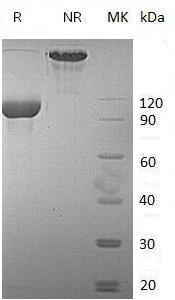 Human EPHA4/HEK8/SEK/TYRO1 (Fc tag) recombinant protein