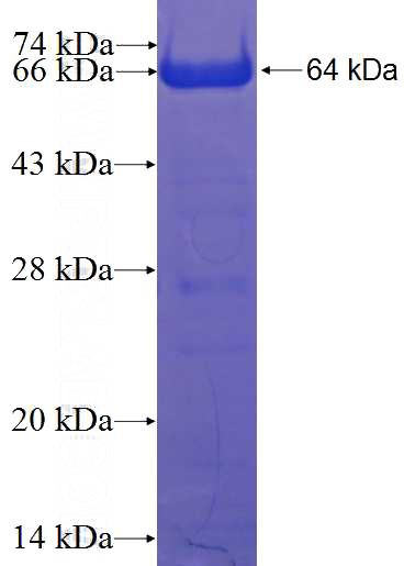 Recombinant Human C1orf113 SDS-PAGE