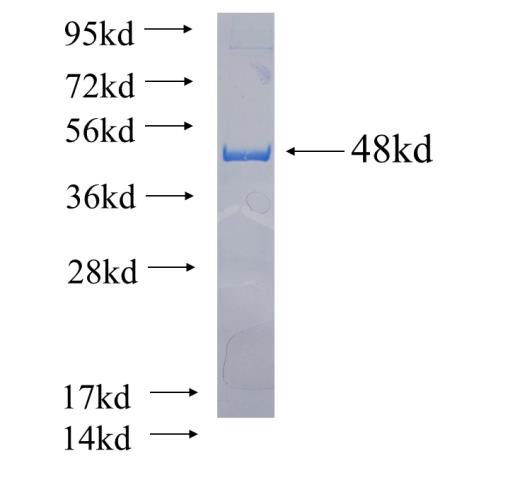 Recombinant human RASSF7 SDS-PAGE