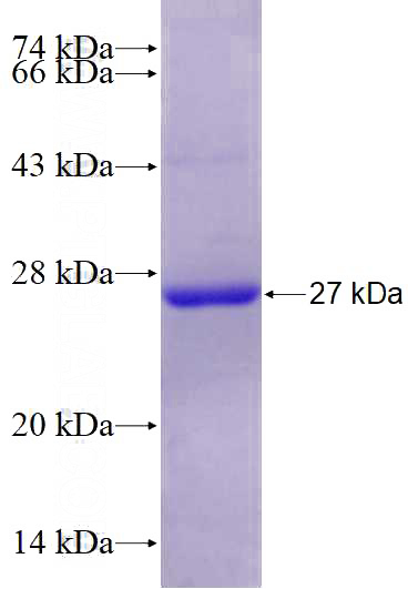 Recombinant Human JMJD5 SDS-PAGE
