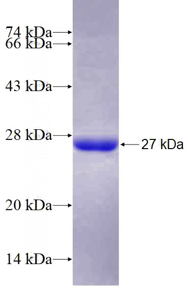 Recombinant Human GUK1 SDS-PAGE