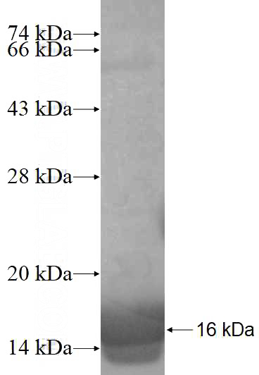 Recombinant Human DYNLL2 SDS-PAGE
