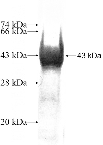 Recombinant Human CLIP4 SDS-PAGE