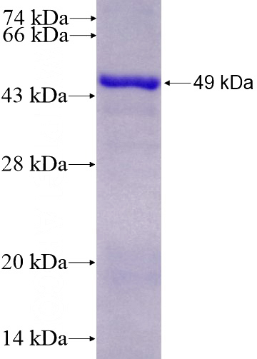 Recombinant Human STK11 SDS-PAGE