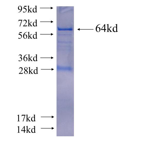 Recombinant human GTPBP5 SDS-PAGE
